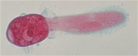  Didinium: Odkryj Małego Mistrza Mycelia Podwodnego!